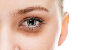 डार्क सर्कल के लिए घरेलू नुस्खे डार्क सर्कल के लिए घरेलू नुस्खे