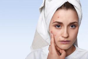 कील-मुँहासे (Acne) से छुटकारा पाने के घरेलू नुस्ख़े कील-मुँहासे (Acne) से छुटकारा पाने के घरेलू नुस्ख़े