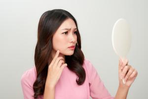 ब्लैकहेड्स हटाने के घरेलू उपाय ब्लैकहेड्स हटाने के घरेलू उपाय