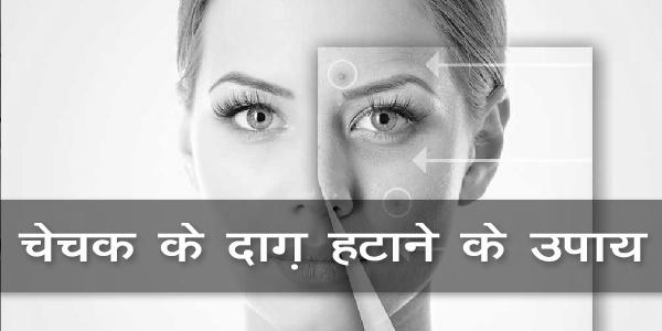 चेचक के दाग़ हटाने के उपाय चेचक के दाग़ हटाने के उपाय