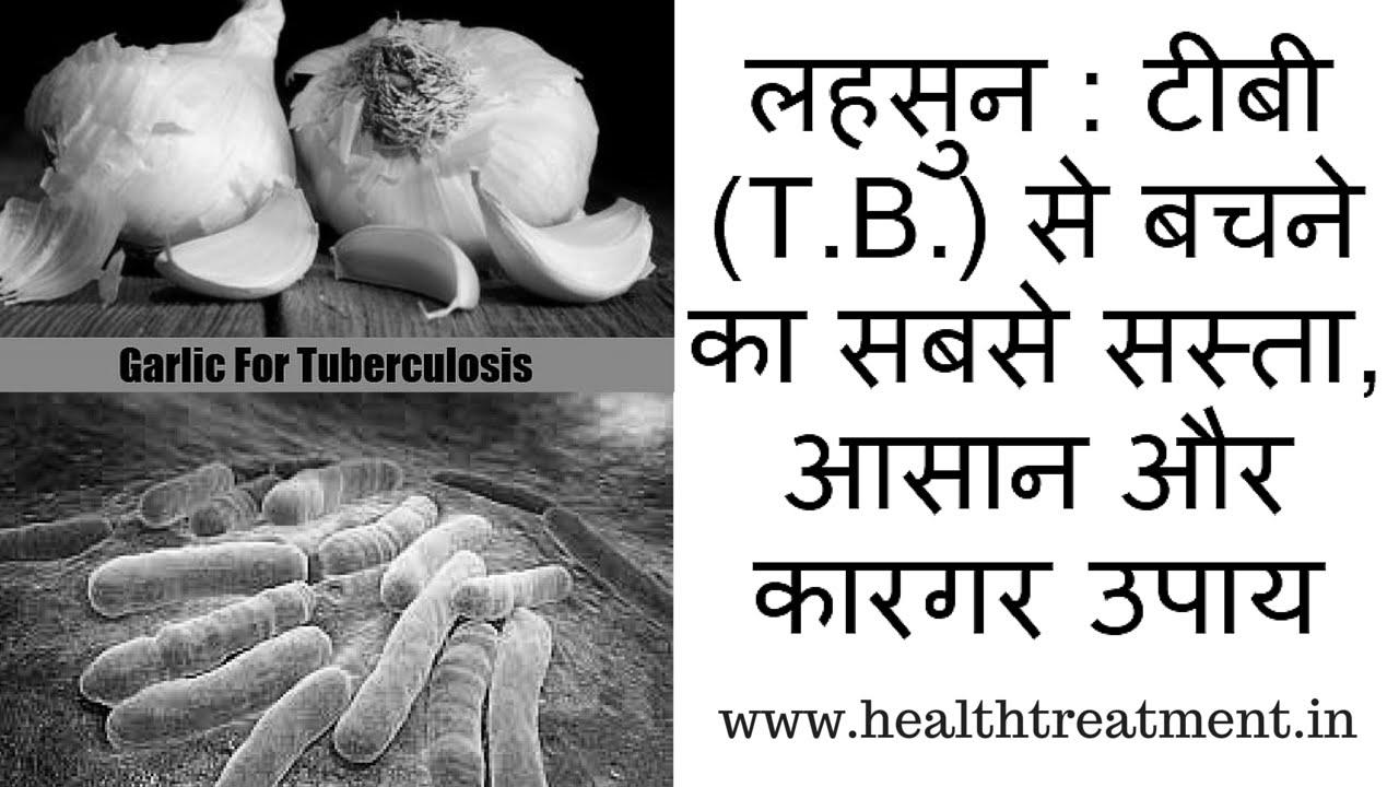 टी .बी से बचाब के घरेलु तरीके टी .बी से बचाब के घरेलु तरीके